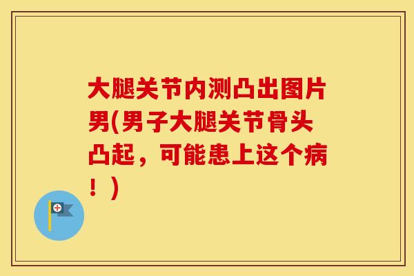 大腿关节内测凸出图片男(男子大腿关节骨头凸起,可能患上这个!) 大腿关节内测凸出图片男(男子大腿关节骨头凸起,可能患上这个!)