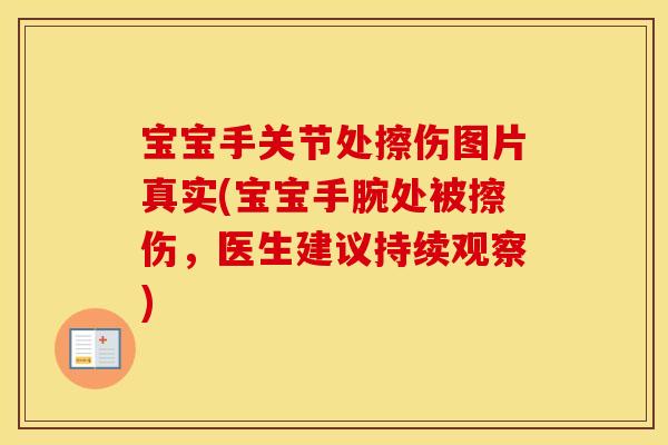 宝宝手关节处擦伤图片真实(宝宝手腕处被擦伤,医生建议持续观察) 宝宝手关节处擦伤图片真实(宝宝手腕处被擦伤,医生建议持续观察)