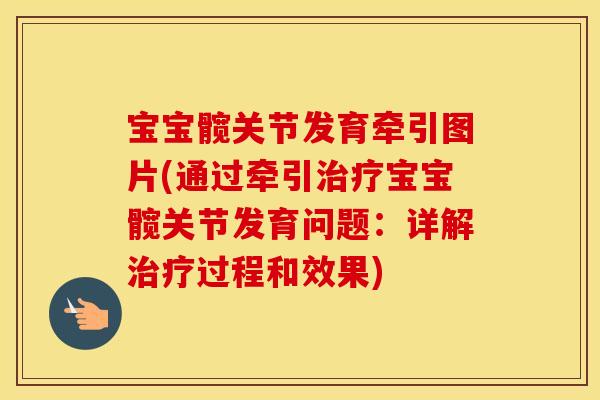 宝宝髋关节发育牵引图片(通过牵引宝宝髋关节发育问题:详解过程和效果) 宝宝髋关节发育牵引图片(通过牵引宝宝髋关节发育问题:详解过程和效果)