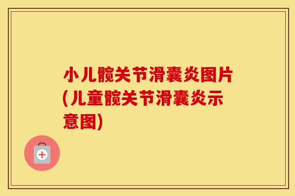 小儿髋关节图片(儿童髋关节示意图)