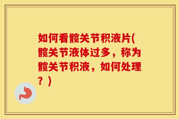 如何看髋关节积液片(髋关节液体过多,称为髋关节积液,如何处理?) 如何看髋关节积液片(髋关节液体过多,称为髋关节积液,如何处理?)