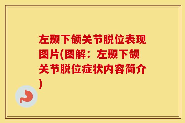 左颞下颌关节脱位表现图片(图解:左颞下颌关节脱位症状内容简介) 左颞下颌关节脱位表现图片(图解:左颞下颌关节脱位症状内容简介)