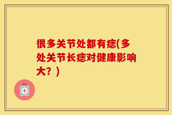 很多关节处都有痣(多处关节长痣对健康影响大?) 很多关节处都有痣(多处关节长痣对健康影响大?)