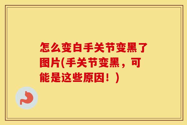 怎么变白手关节变黑了图片(手关节变黑,可能是这些原因!) 怎么变白手关节变黑了图片(手关节变黑,可能是这些原因!)