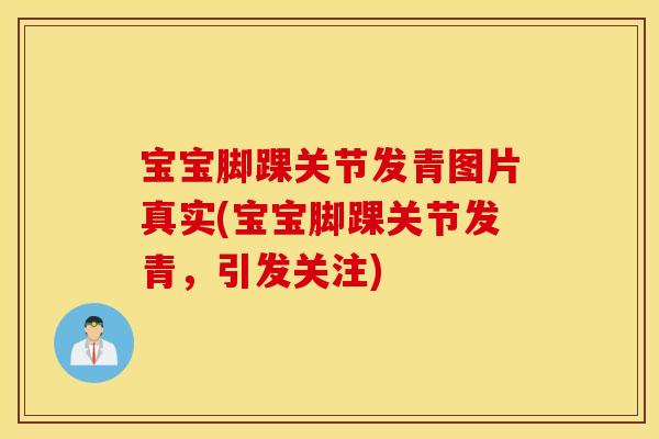 宝宝脚踝关节发青图片真实(宝宝脚踝关节发青，引发关注)