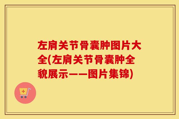 左肩关节骨囊肿图片大全(左肩关节骨囊肿全貌展示——图片集锦) 左肩关节骨囊肿图片大全(左肩关节骨囊肿全貌展示——图片集锦)