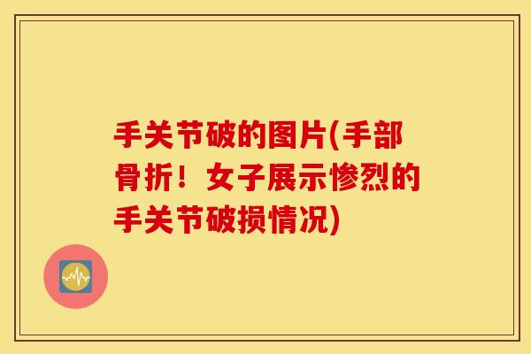 手关节破的图片(手部!女子展示惨烈的手关节破损情况) 手关节破的图片(手部!女子展示惨烈的手关节破损情况)