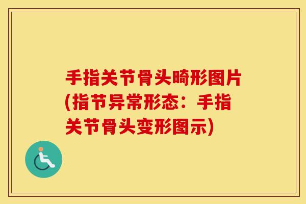 手指关节骨头畸形图片(指节异常形态：手指关节骨头变形图示)