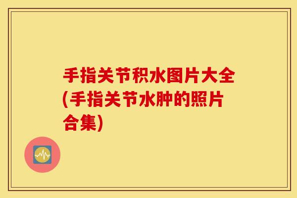 手指关节积水图片大全(手指关节水肿的照片合集)