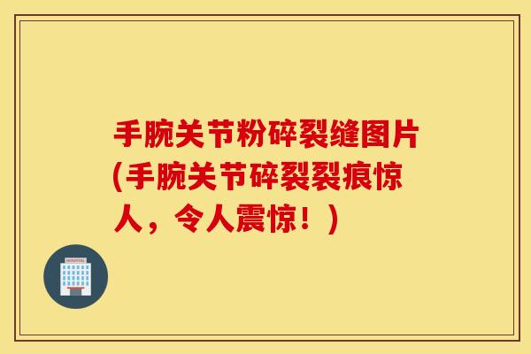 手腕关节粉碎裂缝图片(手腕关节碎裂裂痕惊人,令人震惊!) 手腕关节粉碎裂缝图片(手腕关节碎裂裂痕惊人,令人震惊!)