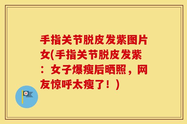 手指关节脱皮发紫图片女(手指关节脱皮发紫：女子爆瘦后晒照，网友惊呼太瘦了！)