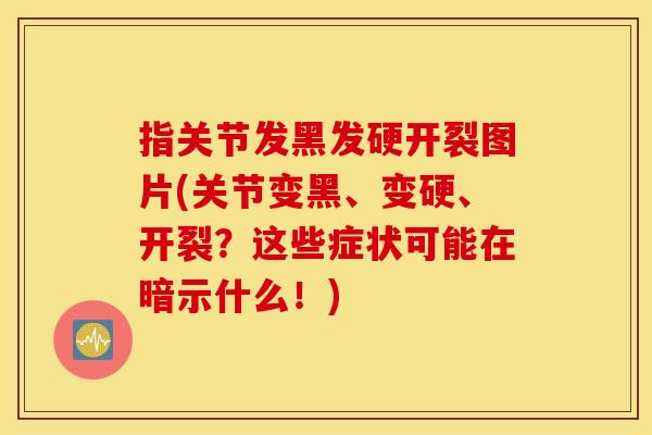 指关节发黑发硬开裂图片(关节变黑、变硬、开裂?这些症状可能在暗示什么!) 指关节发黑发硬开裂图片(关节变黑、变硬、开裂?这些症状可能在暗示什么!)