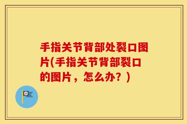 手指关节背部处裂口图片(手指关节背部裂口的图片,怎么办?) 手指关节背部处裂口图片(手指关节背部裂口的图片,怎么办?)