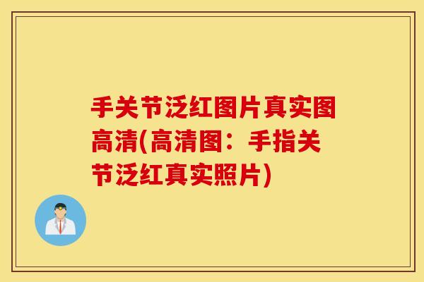 手关节泛红图片真实图高清(高清图:手指关节泛红真实照片) 手关节泛红图片真实图高清(高清图:手指关节泛红真实照片)