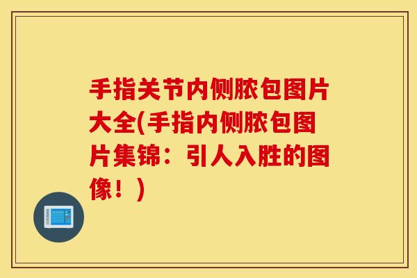 手指关节内侧脓包图片大全(手指内侧脓包图片集锦:引人入胜的图像!) 手指关节内侧脓包图片大全(手指内侧脓包图片集锦:引人入胜的图像!)