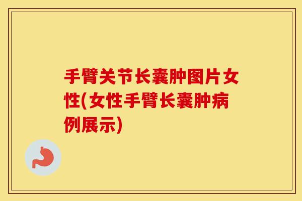 手臂关节长囊肿图片女性(女性手臂长囊肿例展示) 手臂关节长囊肿图片女性(女性手臂长囊肿例展示)