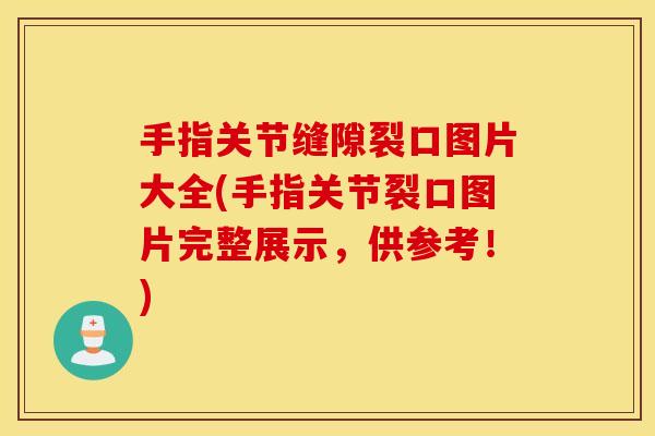 手指关节缝隙裂口图片大全(手指关节裂口图片完整展示,供参考!) 手指关节缝隙裂口图片大全(手指关节裂口图片完整展示,供参考!)