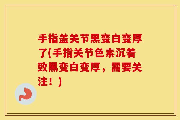 手指盖关节黑变白变厚了(手指关节色素沉着致黑变白变厚,需要关注!) 手指盖关节黑变白变厚了(手指关节色素沉着致黑变白变厚,需要关注!)