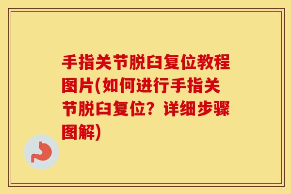 手指关节脱臼复位教程图片(如何进行手指关节脱臼复位?详细步骤图解) 手指关节脱臼复位教程图片(如何进行手指关节脱臼复位?详细步骤图解)