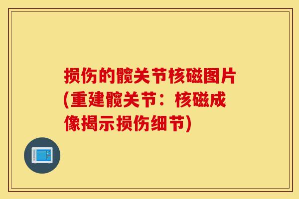 损伤的髋关节核磁图片(重建髋关节:核磁成像揭示损伤细节) 损伤的髋关节核磁图片(重建髋关节:核磁成像揭示损伤细节)