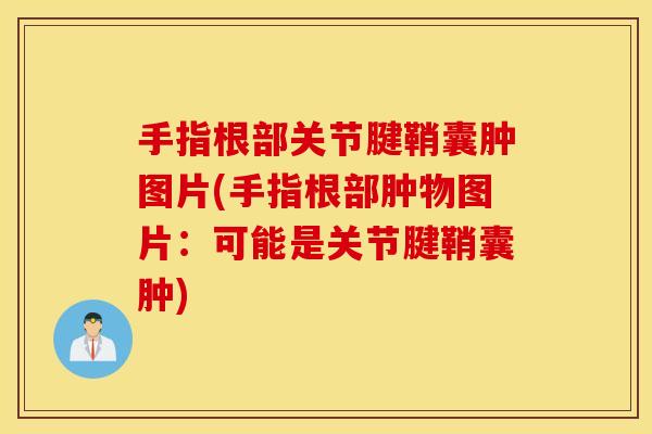 手指根部关节腱鞘囊肿图片(手指根部肿物图片：可能是关节腱鞘囊肿)