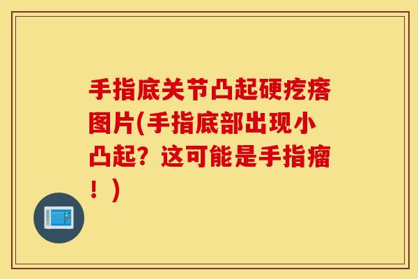 手指底关节凸起硬疙瘩图片(手指底部出现小凸起?这可能是手指瘤!) 手指底关节凸起硬疙瘩图片(手指底部出现小凸起?这可能是手指瘤!)
