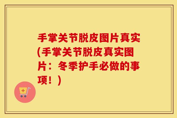 手掌关节脱皮图片真实(手掌关节脱皮真实图片：冬季护手必做的事项！)
