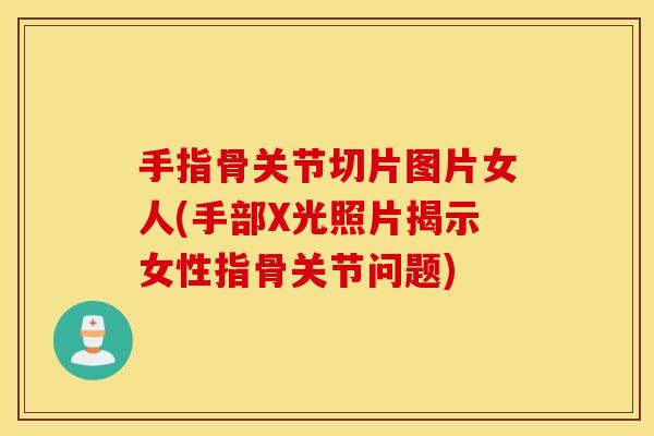 手指骨关节切片图片女人(手部X光照片揭示女性指骨关节问题) 手指骨关节切片图片女人(手部X光照片揭示女性指骨关节问题)