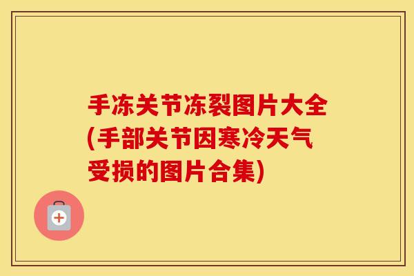 手冻关节冻裂图片大全(手部关节因寒冷天气受损的图片合集) 手冻关节冻裂图片大全(手部关节因寒冷天气受损的图片合集)