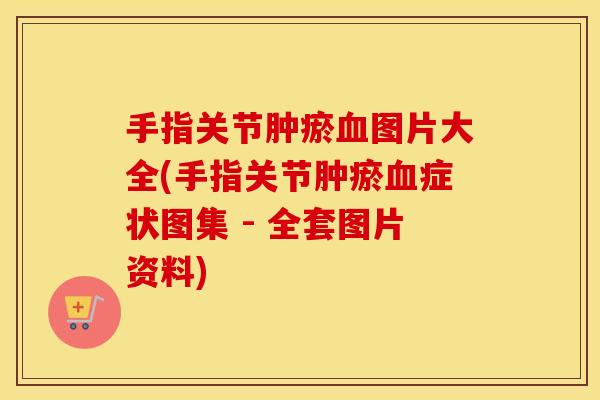 手指关节肿瘀图片大全(手指关节肿瘀症状图集 - 全套图片资料) 手指关节肿瘀图片大全(手指关节肿瘀症状图集 - 全套图片资料)