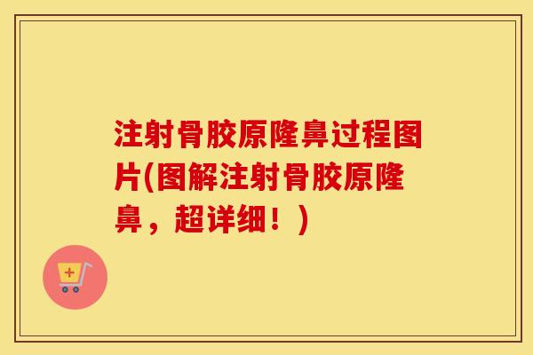 注射骨胶原隆鼻过程图片(图解注射骨胶原隆鼻，超详细！)