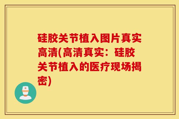 硅胶关节植入图片真实高清(高清真实:硅胶关节植入的医疗现场揭密) 硅胶关节植入图片真实高清(高清真实:硅胶关节植入的医疗现场揭密)
