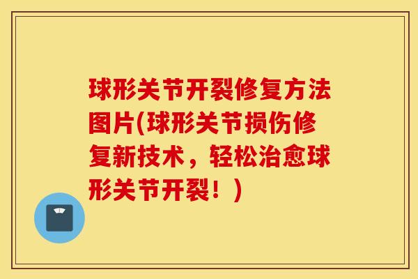 球形关节开裂修复方法图片(球形关节损伤修复新技术,轻松愈球形关节开裂!) 球形关节开裂修复方法图片(球形关节损伤修复新技术,轻松愈球形关节开裂!)