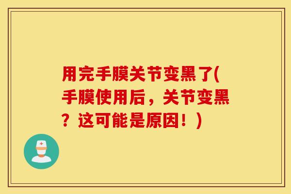 用完手膜关节变黑了(手膜使用后,关节变黑?这可能是原因!) 用完手膜关节变黑了(手膜使用后,关节变黑?这可能是原因!)