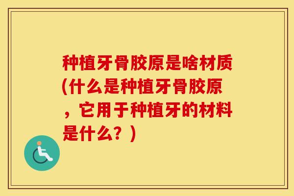 种植牙骨胶原是啥材质(什么是种植牙骨胶原,它用于种植牙的材料是什么?) 种植牙骨胶原是啥材质(什么是种植牙骨胶原,它用于种植牙的材料是什么?)