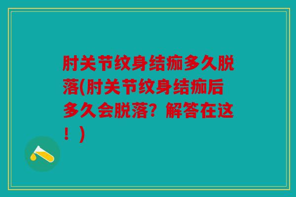 肘关节纹身结痂多久脱落(肘关节纹身结痂后多久会脱落?解答在这!) 肘关节纹身结痂多久脱落(肘关节纹身结痂后多久会脱落?解答在这!)