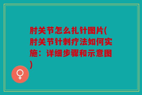 肘关节怎么扎针图片(肘关节针刺疗法如何实施:详细步骤和示意图) 肘关节怎么扎针图片(肘关节针刺疗法如何实施:详细步骤和示意图)
