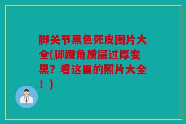 脚关节黑色死皮图片大全(脚踝角质层过厚变黑?看这里的照片大全!) 脚关节黑色死皮图片大全(脚踝角质层过厚变黑?看这里的照片大全!)