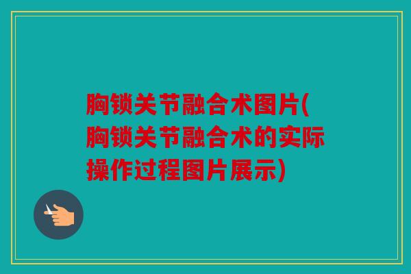 胸锁关节融合术图片(胸锁关节融合术的实际操作过程图片展示) 胸锁关节融合术图片(胸锁关节融合术的实际操作过程图片展示)