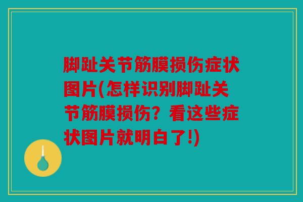 脚趾关节筋膜损伤症状图片(怎样识别脚趾关节筋膜损伤?看这些症状图片就明白了!) 脚趾关节筋膜损伤症状图片(怎样识别脚趾关节筋膜损伤?看这些症状图片就明白了!)
