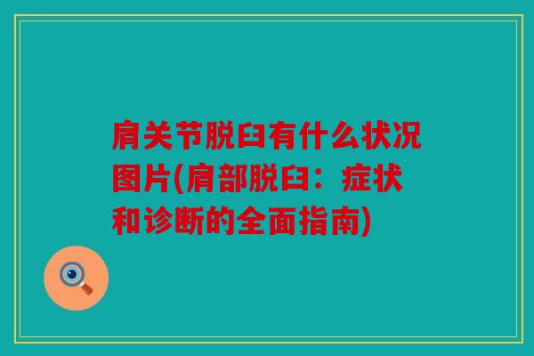 肩关节脱臼有什么状况图片(肩部脱臼:症状和诊断的全面指南) 肩关节脱臼有什么状况图片(肩部脱臼:症状和诊断的全面指南)