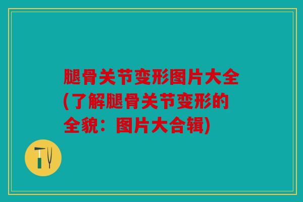 腿骨关节变形图片大全(了解腿骨关节变形的全貌:图片大合辑) 腿骨关节变形图片大全(了解腿骨关节变形的全貌:图片大合辑)