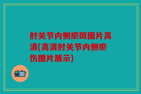 肘关节内侧瘀斑图片高清(高清肘关节内侧瘀伤图片展示)