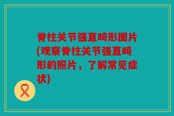 脊柱关节强直畸形图片(观察脊柱关节强直畸形的照片,了解常见症状) 脊柱关节强直畸形图片(观察脊柱关节强直畸形的照片,了解常见症状)