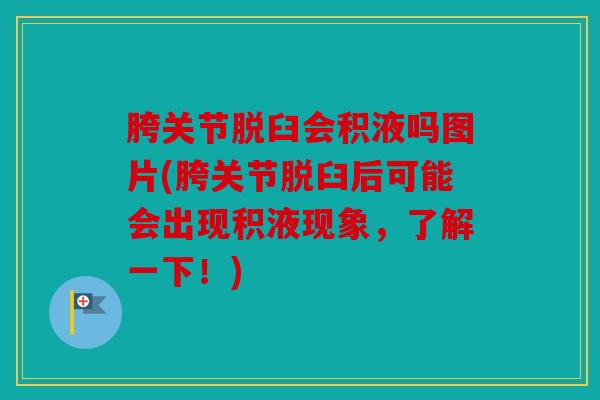 胯关节脱臼会积液吗图片(胯关节脱臼后可能会出现积液现象,了解一下!) 胯关节脱臼会积液吗图片(胯关节脱臼后可能会出现积液现象,了解一下!)