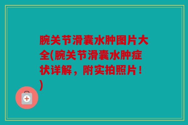 腕关节滑囊水肿图片大全(腕关节滑囊水肿症状详解，附实拍照片！)