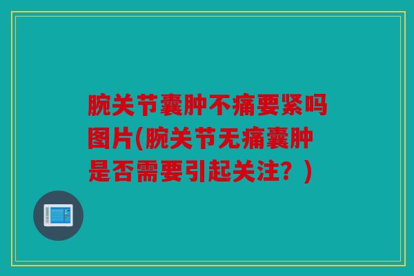 腕关节囊肿不痛要紧吗图片(腕关节无痛囊肿是否需要引起关注?) 腕关节囊肿不痛要紧吗图片(腕关节无痛囊肿是否需要引起关注?)