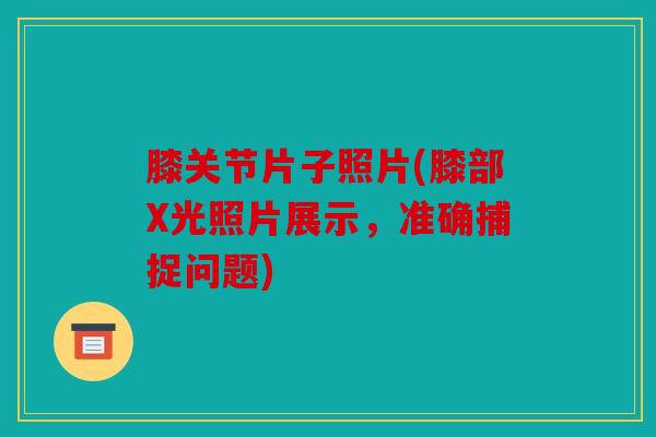 膝关节片子照片(膝部X光照片展示,准确捕捉问题) 膝关节片子照片(膝部X光照片展示,准确捕捉问题)