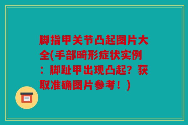 脚指甲关节凸起图片大全(手部畸形症状实例：脚趾甲出现凸起？获取准确图片参考！)