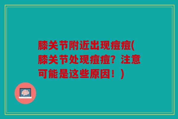 膝关节附近出现痘痘(膝关节处现痘痘?注意可能是这些原因!) 膝关节附近出现痘痘(膝关节处现痘痘?注意可能是这些原因!)